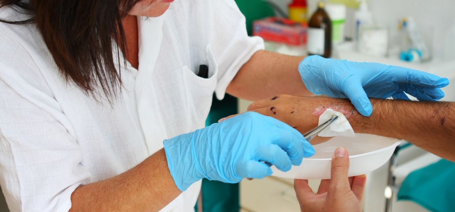 curacion de heridas